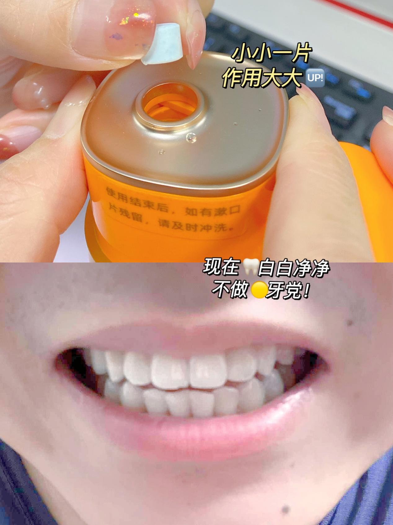 Coficoli可菲可丽洁白冲牙器，4大喷嘴+5种模式，牙齿护理面面俱到