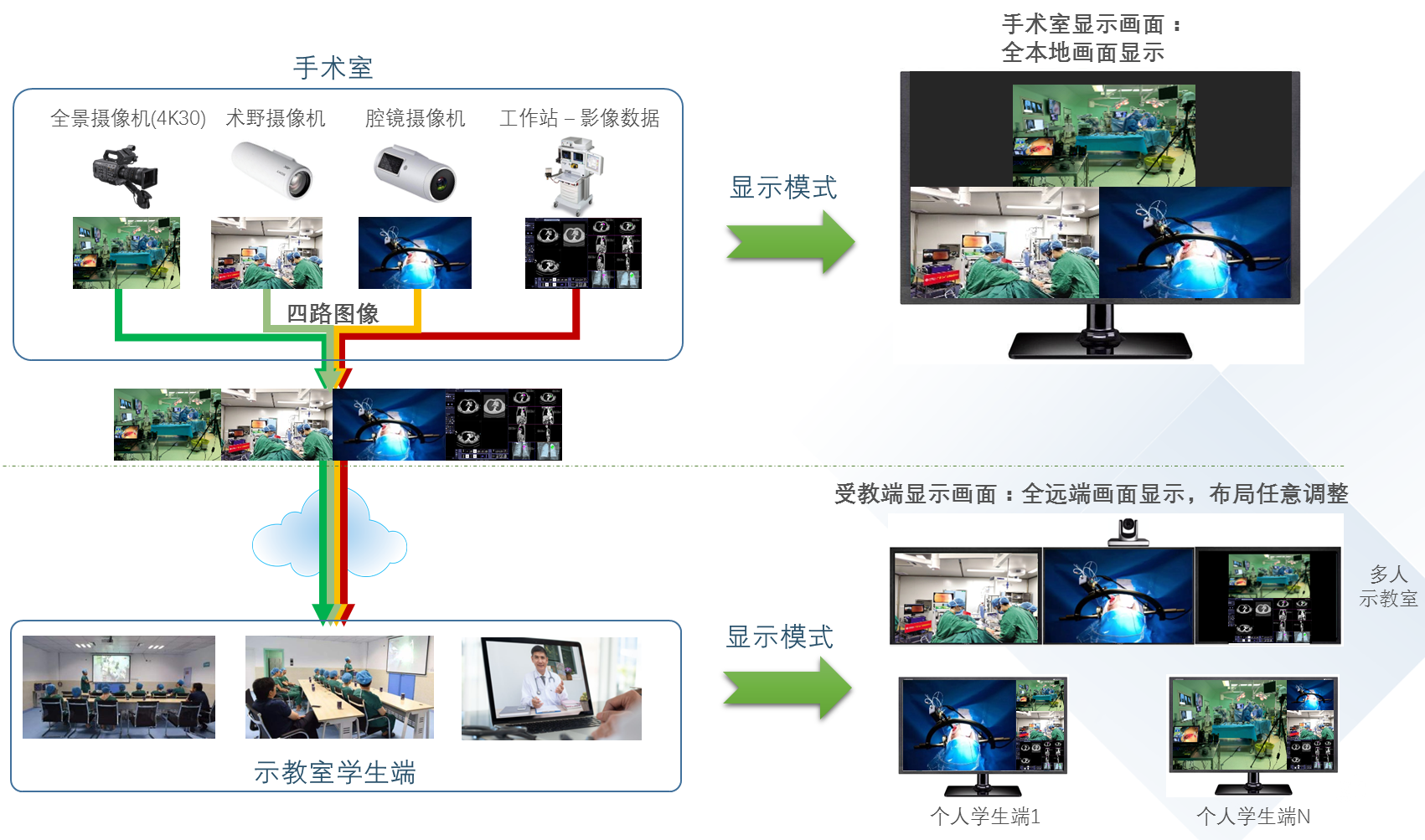 4K多通道手术示教/数字化手术室系统